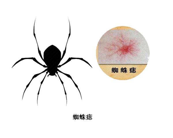 快速问医生|身上出现很多小红点，不痛不痒？以下几种异常要提高警惕