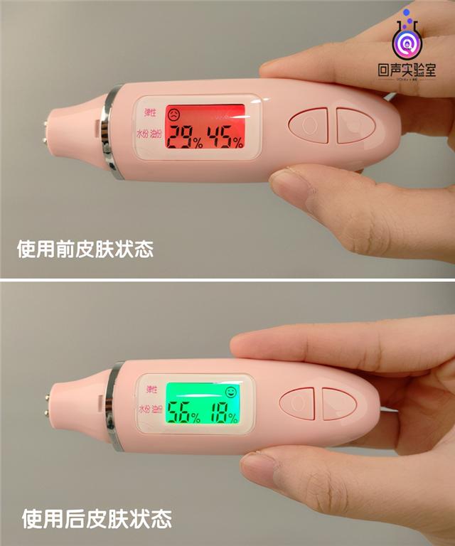 婴儿 好品速递|打赢宝宝秋燥护肤保卫战?庆宝生护肤乳评测开整