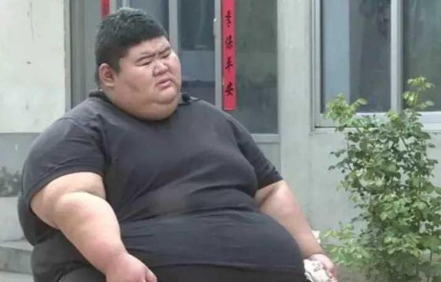 医生|他体重高达688斤，一年暴瘦450斤收获女神，最终逆袭百万粉丝网红