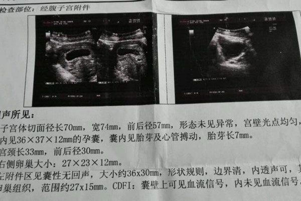 脊柱呈串珠样排列是男孩女孩?