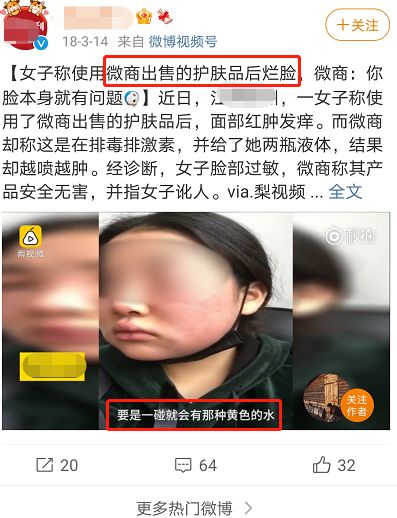 护肤品 怀孕不能用护肤品，会致畸？网友：怪不得这么早就被叫“阿姨”