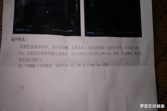 罗医生说健康|34岁女子查出乳腺结节，医生：常吃1“零食”，或可消散结节