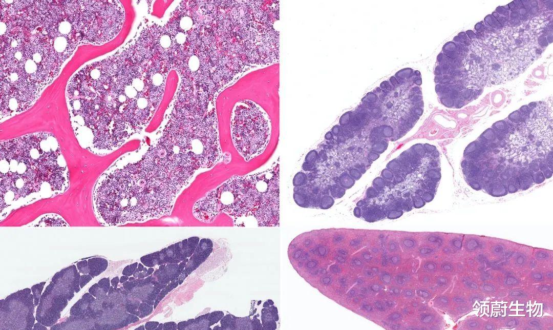肾衰竭|干细胞移植有望代替透析、换肾，肾衰不再别无选择！