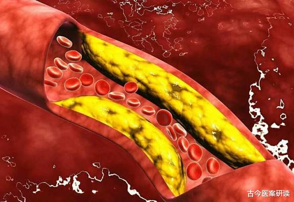 血栓|“溶栓高手”被发现,不是山楂,你若爱吃,血管畅通,远离头晕眼花