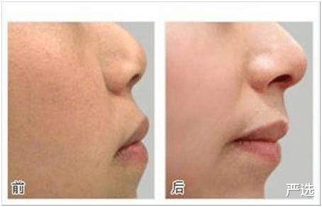 严选|8年前整容成白雪公主的女人,如今竟成这般模样?网友:难以相信