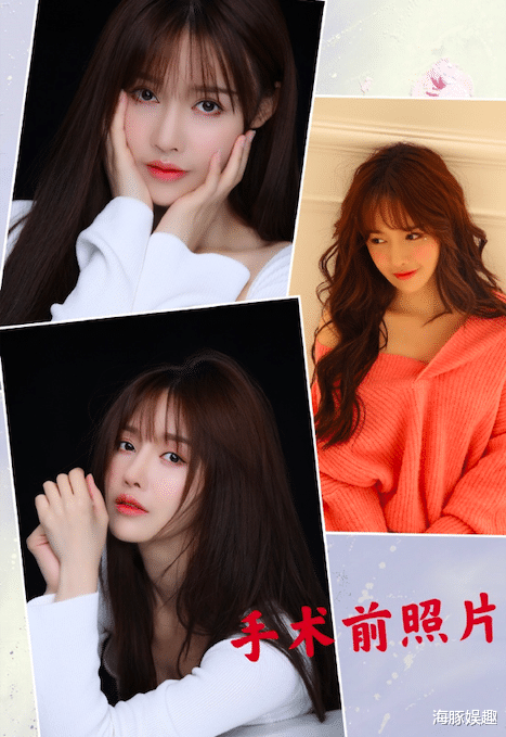 李承铉|31岁女星自曝微调失败遭毁容，鼻头感染触目惊心，维权无果欲轻生