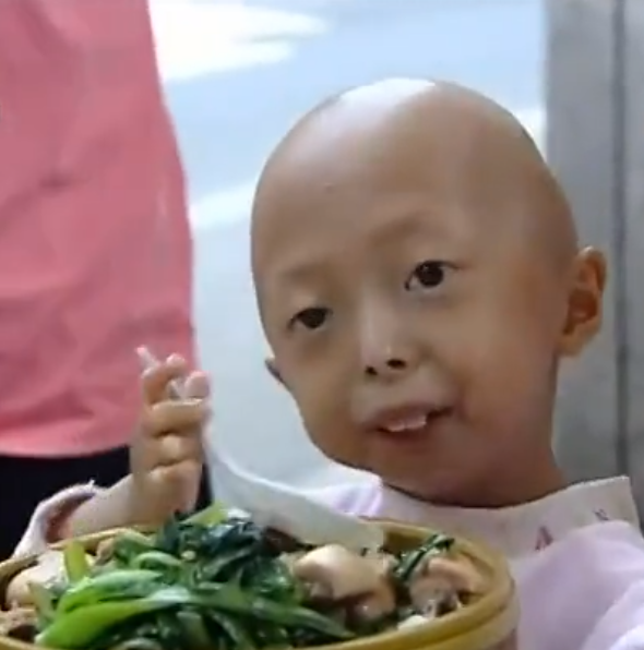 外星人 她们被外界人称“外星人”，健康的父母为何会生出长相怪异的孩子