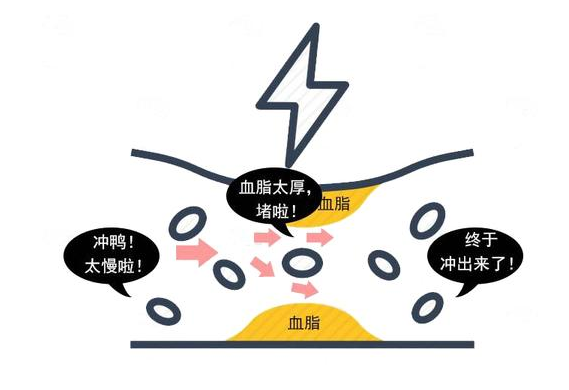 近视|预防脑梗，从“吃”上下功夫！5种食物每天适量吃，清理血管垃圾