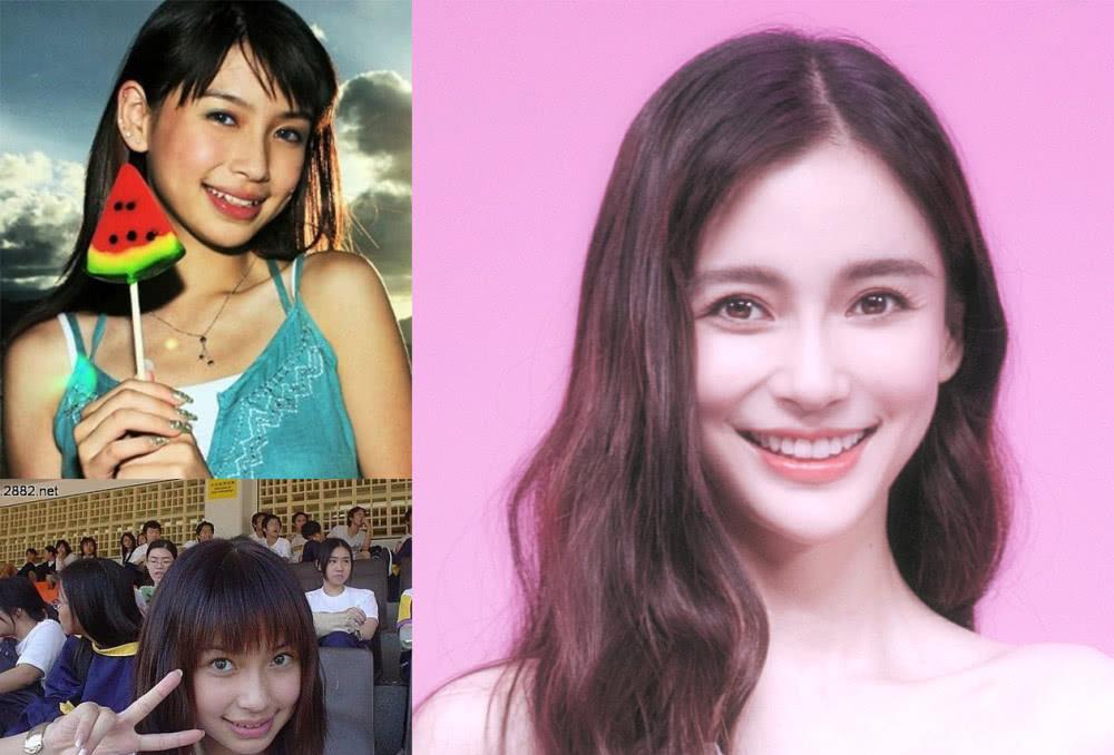 刘涛|明星“假牙”大pk：刘涛花300万整牙，吴昕的牙齿变黢黑