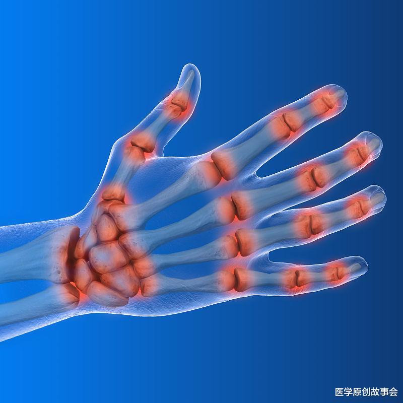 医学原创故事会|远离痛风，请记住，晨起两坚持，晚上三不要，你的尿酸才会更好
