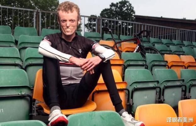 菠萝蜜|苏格兰少年患罕见疾病，全球仅12例，骨瘦如柴永远长不胖