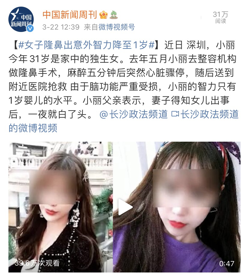整容|又一个被辱骂丑的女明星：整容怪，别来中国圈钱