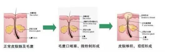 好物官|《我家那闺女》宋茜素颜上镜，镜头下“牛奶肌”，吊打昔日队友