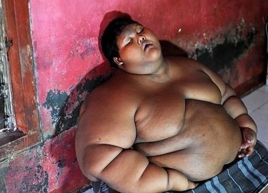 |那个400斤世界最胖小孩，你还记得吗？如今减肥成功，帅到认不出