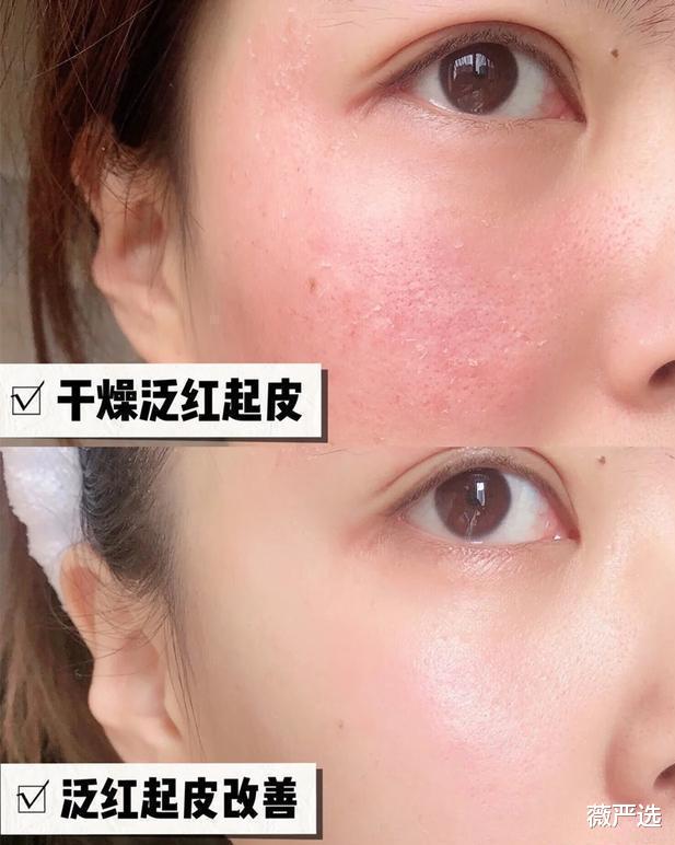 护肤品 提醒女生：护肤品并不是越多越好，尤其是这4种，少用对皮肤更好