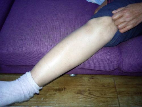 经络|身体这位六大信号，你要小心经络不通了