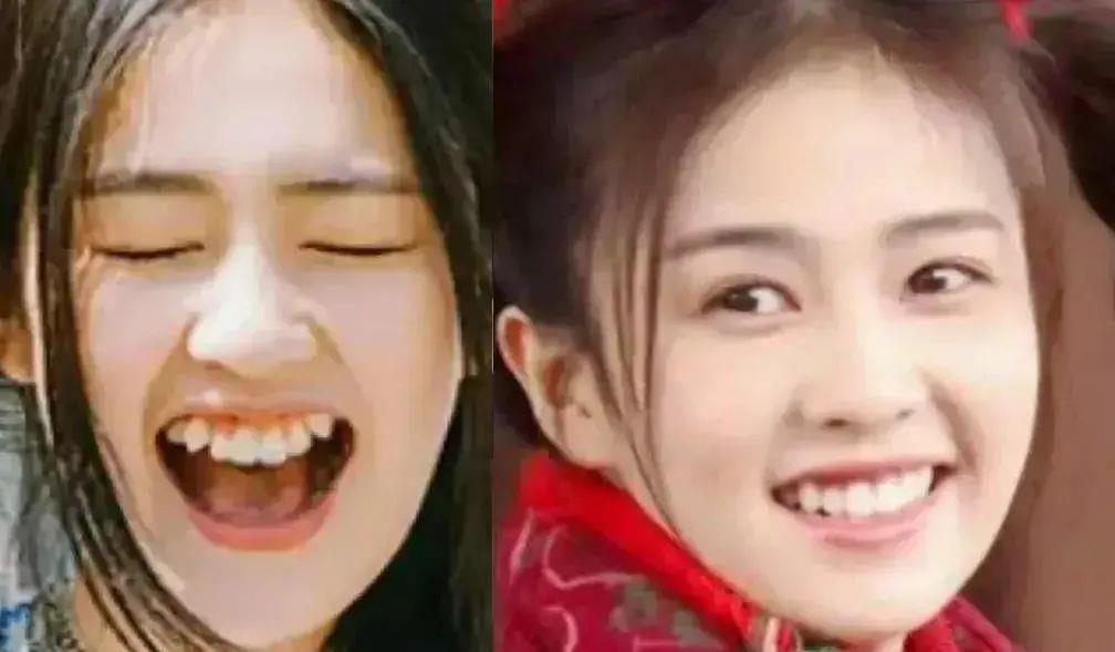 唐嫣|明星的一口乱牙，范冰冰唐嫣整牙后提升颜值，甘望星的牙齿需矫正