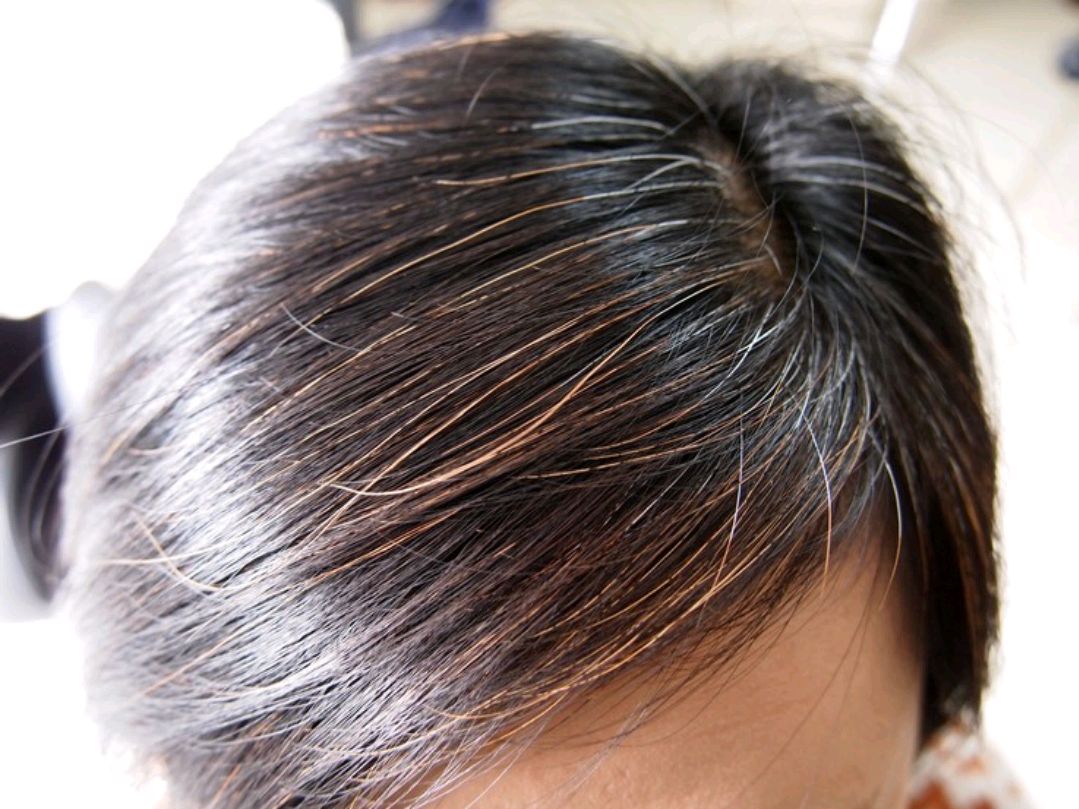 白发|长出了白头发别急着染,不妨多补充3类营养,白发或许有望转黑发