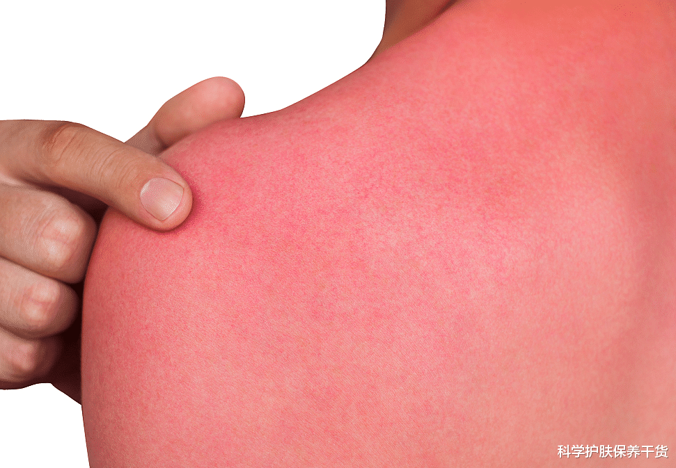 护肤|皮肤晒黑了怎么快速白回来？一次性告诉你，快速白回来的全部方法！