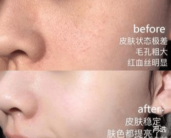 严选|王鸥不小心晒出的面膜, 却因价格太低被无视, 网友: 3次白的像牛奶!
