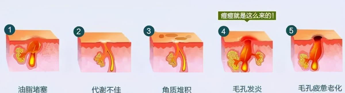 |建议大家：若不差钱，卫生间添置这3样“好物”，日子越过越顺心