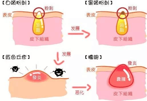 洗面奶 去油洗面奶好用吗 补水控油洗面奶推荐