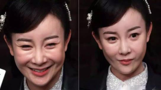 整容|6位整容的女明星曾经有多么美？别人是把自己变美，她们是整残了