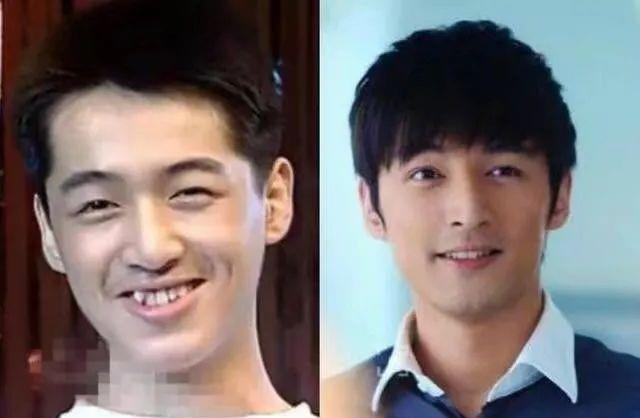 唐嫣|明星的一口乱牙，范冰冰唐嫣整牙后提升颜值，甘望星的牙齿需矫正