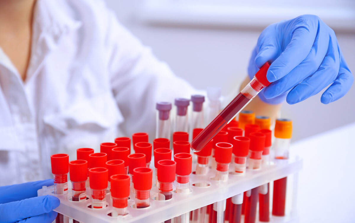 用户_胡洋|是时候测测电子烟肺炎患者血液样本新冠抗体了，答案或许就在其中