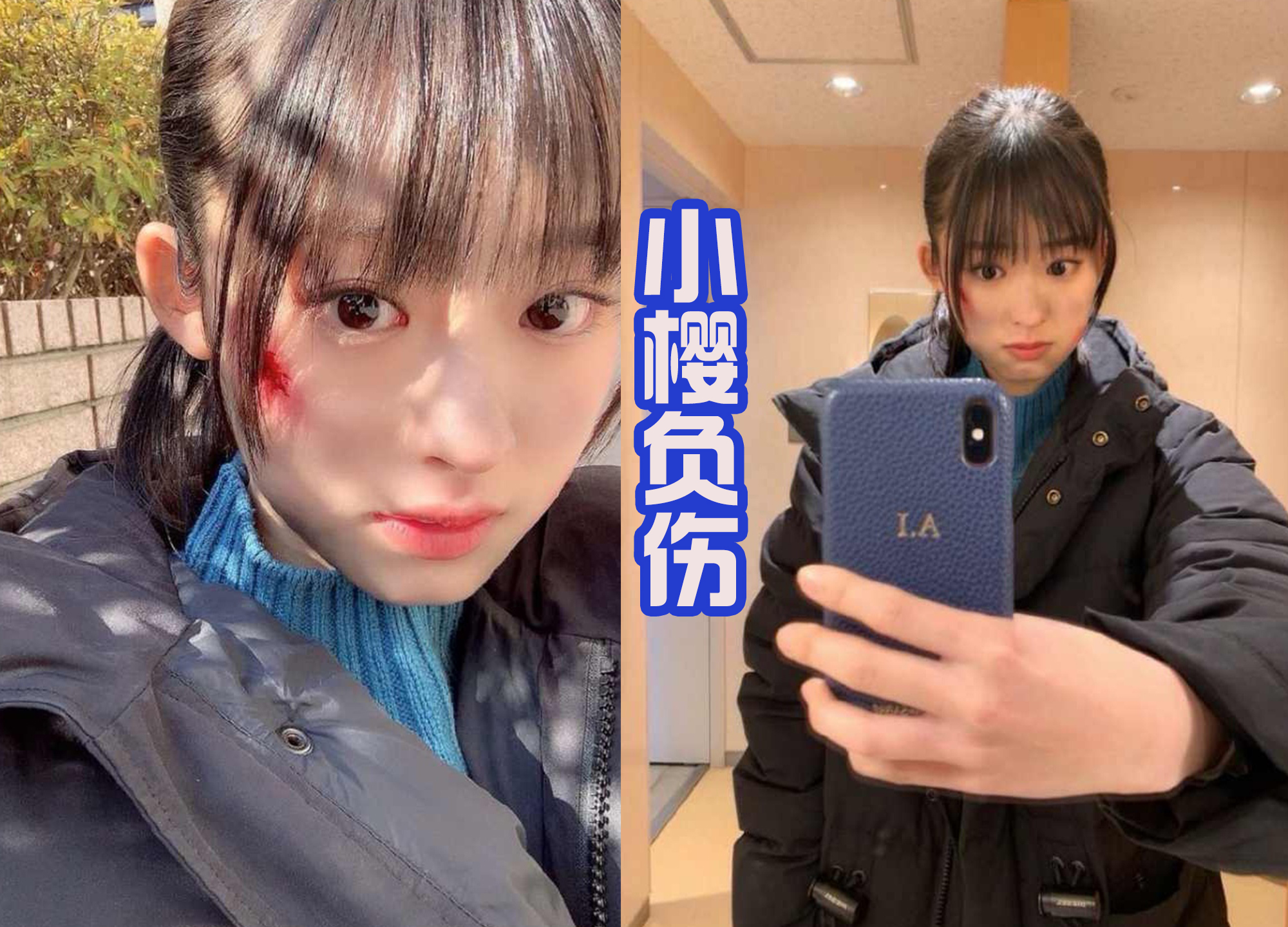 假面骑士|五十岚樱晒剧照负伤，接下来假面骑士贞德要吃瘪？非常有可能