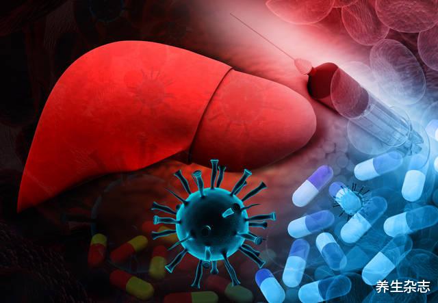 肝癌|夫妻双双查出肝癌,3月后离世,医生直言:砧板经常换,为何不换“它”?
