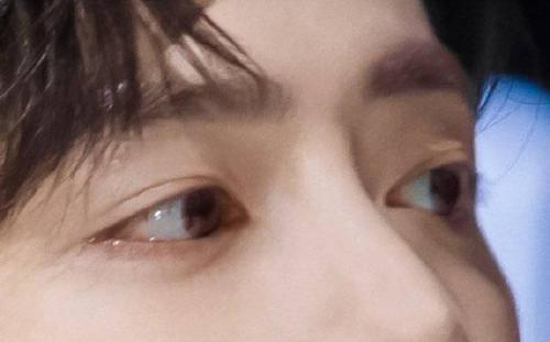 木耳|眼修复孙沣博士:那眼眸倾泻一汪柔情,如一池清澈的湖水