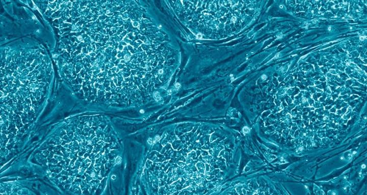 中科西部细胞研究院|中科西部干细胞研究院:不老的神秘面纱 ?