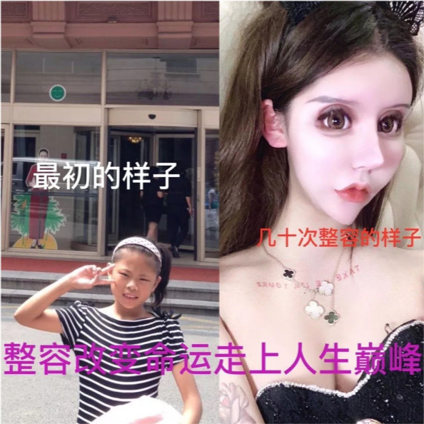 张卫健|15岁女网红花费400万整容成瘾，天天晒照自认为很美，网友吐槽像60岁