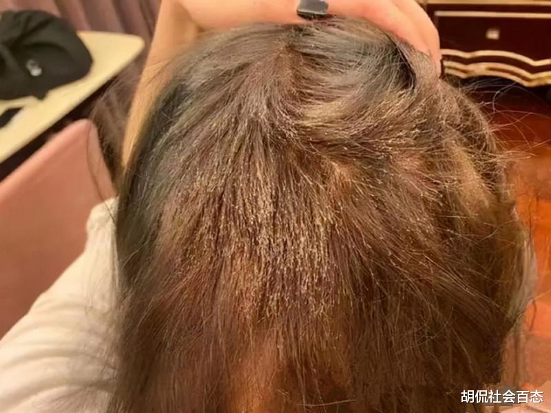 染发 杭州：女生花千元染发却被染成了“狗啃式”，女生发起天价索赔