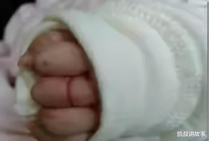 凯叔讲故事 4岁女童幼儿园午睡时，手指头被“皮筋”咬住，竟险些被截“指”