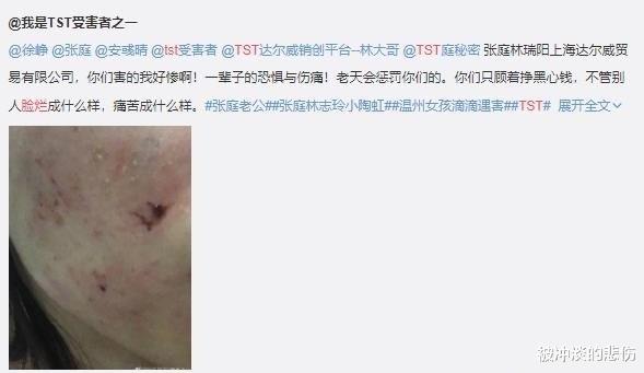 张庭|张庭惊人资产遭全面查封，骗局背后另有操控？陶虹受牵人人喊打！