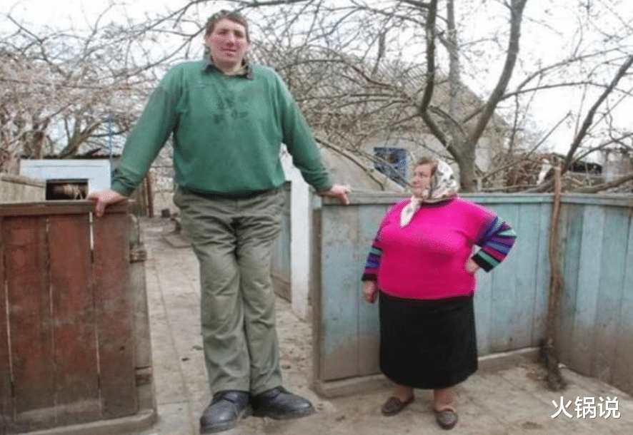 巨人症 他前半生是侏儒后半生是巨人，前后身高差94厘米，全球仅此一例