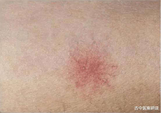 肝癌|38岁男子不痛不痒，确诊肝癌，医生：身体早有提醒，是自己不重视