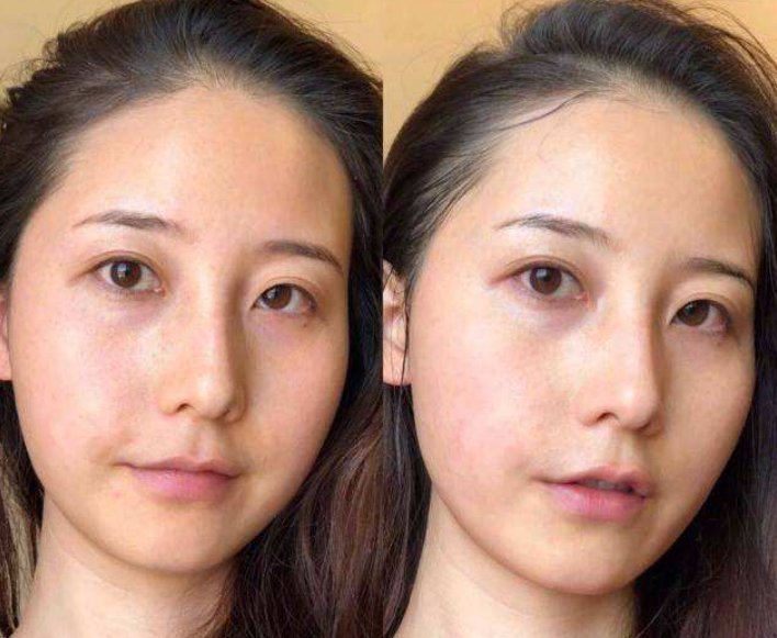 排便|女性衰老的五个特点，如果你全中了，不要拒绝接受，你可能已经老了