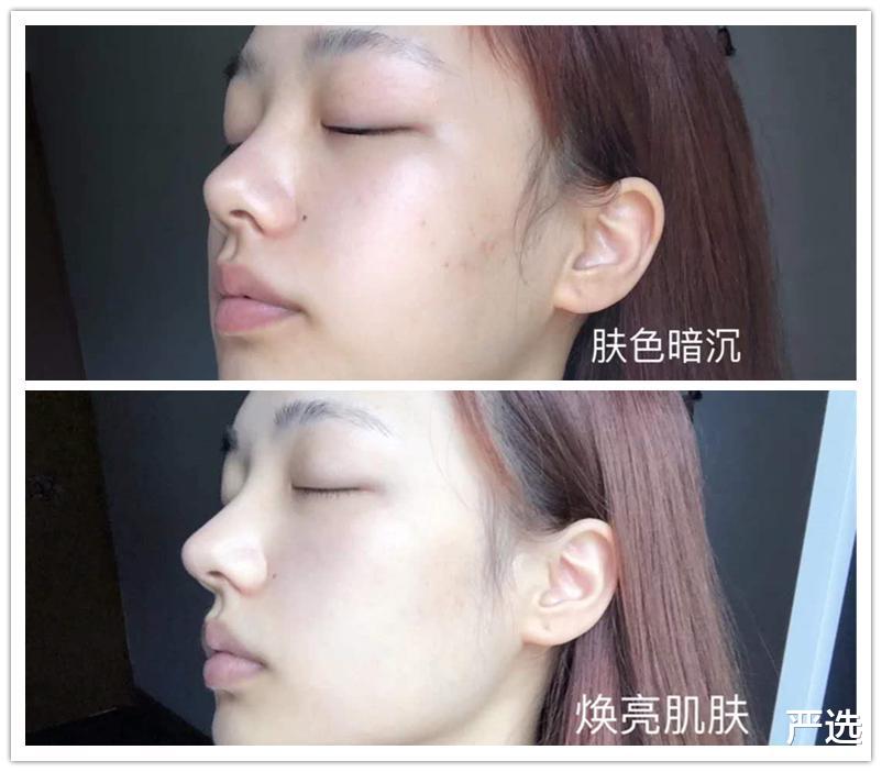 严选|女星的3种美白方式,特别容易“烂脸”损伤肌肤,你都用过哪个?