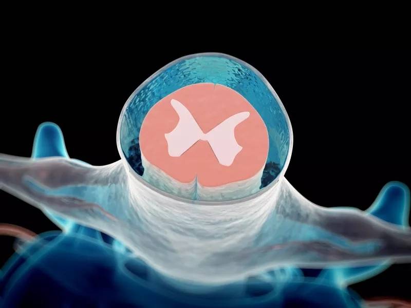 神经元 临床案例：神经干细胞移植干预治疗脊髓损伤的五大机制