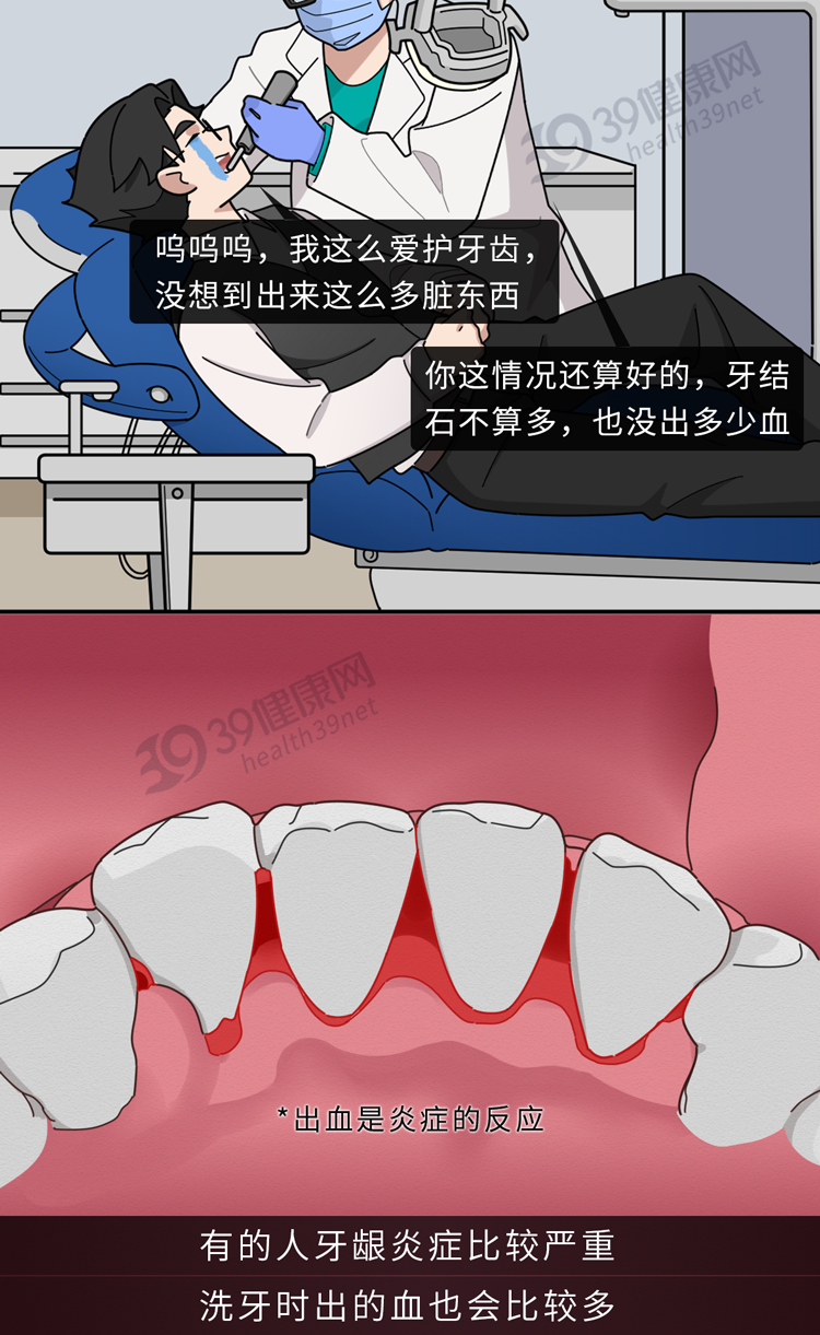 牙齿|不洗牙，你永远不知道牙齿里面有多脏！看完这篇就拿定主意了