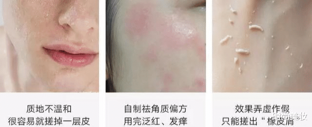 |想要同款李小冉“牛奶肌”？这一点很关键！很多人都忽略了