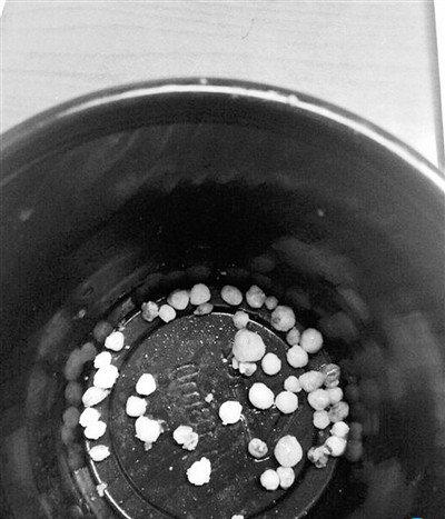 舜网 女子餐厅吃海蛎子,觉得硌牙,接连吐出了50多颗珍珠