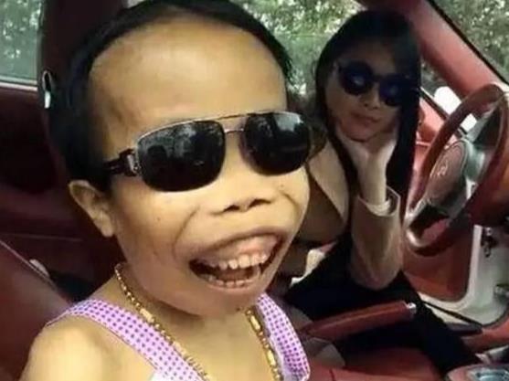 陈山|“外星人”陈山患地中海贫血，娇妻却怀孕七个半月，网友：作孽