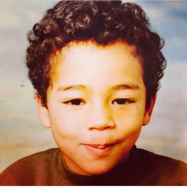 InsDaily 他被嘲“整形怪”10年！如今自曝毁容烧伤照，网友：又来炒作！