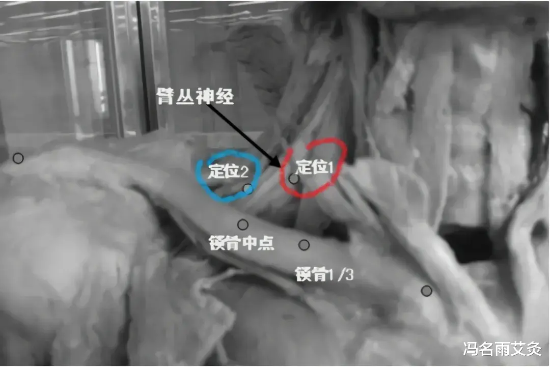 冯名雨艾灸|手麻预示什么病？两个穴位，轻松缓解手麻