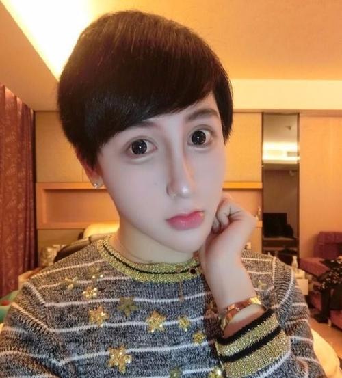 整容|知名网红整容失败消失2年,痛哭流涕:我做脂肪填充后老了20岁变成丑八怪