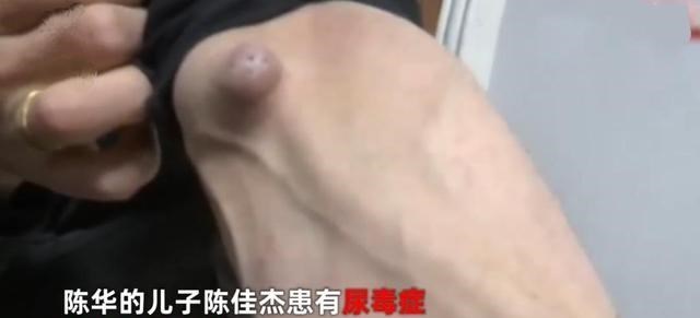 体坛一枝的 南通一老人借亲戚40万未还，如今儿子换肾无钱，网友：良心不痛吗